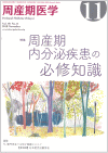 Yw48-11